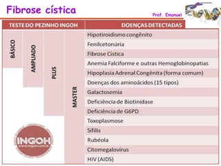 Fibrose cística Prof. Emanuel
 