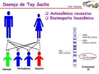  Autossômica recessiva
 Enzimopatia lisossômica
Doença de Tay Sachs Prof. Emanuel
Cromossomo
15Normal Portadores Doente
 