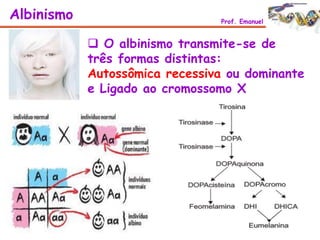  O albinismo transmite-se de
três formas distintas:
Autossômica recessiva ou dominante
e Ligado ao cromossomo X
Albinismo Prof. Emanuel
 