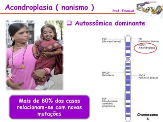  Autossômica dominante
Acondroplasia ( nanismo ) Prof. Emanuel
Cromossomo
4
Mais de 80% dos casos
relacionam-se com novas
mutações
 