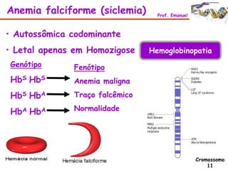 • Autossômica codominante
• Letal apenas em Homozigose
Genótipo
HbS HbS
HbS HbA
HbA HbA
Fenótipo
Anemia maligna
Traço falcêmico
Normalidade
Anemia falciforme (siclemia) Prof. Emanuel
Cromossomo
11
Hemoglobinopatia
 