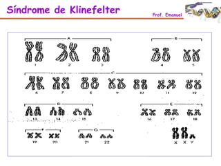Síndrome de Klinefelter Prof. Emanuel
 