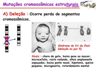 A) Deleção : Ocorre perda de segmentos
cromossômicos.
Síndrome do Cri du Chat
(deleção no par 5)
Sinais : choro de gato, baixo peso ao nascer,
microcefalia, rosto redondo, olhos amplamente
espaçados, baixa ponte nasal, hipotonia, queixo
pequeno, micrognastia, retardamento mental
Mutações cromossômicas estruturaisProf. Emanuel
 