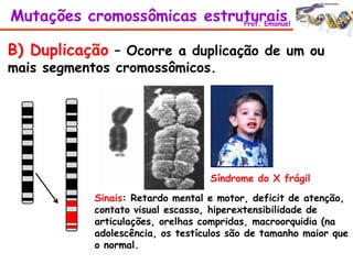 B) Duplicação – Ocorre a duplicação de um ou
mais segmentos cromossômicos.
Sinais: Retardo mental e motor, deficit de atenção,
contato visual escasso, hiperextensibilidade de
articulações, orelhas compridas, macroorquidia (na
adolescência, os testículos são de tamanho maior que
o normal.
Síndrome do X frágil
Mutações cromossômicas estruturaisProf. Emanuel
 