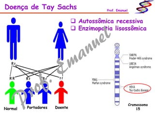  Autossômica recessiva
 Enzimopatia lisossômica
Doença de Tay Sachs Prof. Emanuel
Cromossomo
15Normal Portadores Doente
 