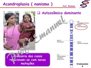  Autossômica dominante
Acondroplasia ( nanismo ) Prof. Emanuel
Cromossomo
4
A maioria dos casos
relacionam-se com novas
mutações
 