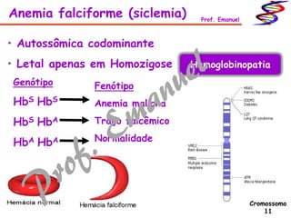 • Autossômica codominante
• Letal apenas em Homozigose
Genótipo
HbS HbS
HbS HbA
HbA HbA
Fenótipo
Anemia maligna
Traço falcêmico
Normalidade
Anemia falciforme (siclemia) Prof. Emanuel
Cromossomo
11
Hemoglobinopatia
 
