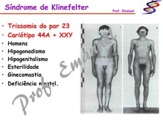 • Trissomia do par 23
• Cariótipo 44A + XXY
• Homens
• Hipogonadismo
• Hipogenitalismo
• Esterilidade
• Ginecomastia
• Deficiência mental.
Síndrome de Klinefelter Prof. Emanuel
 