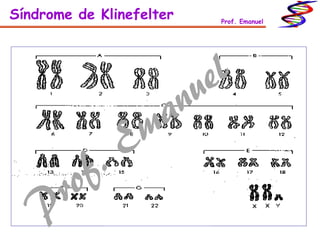 Síndrome de Klinefelter Prof. Emanuel
 