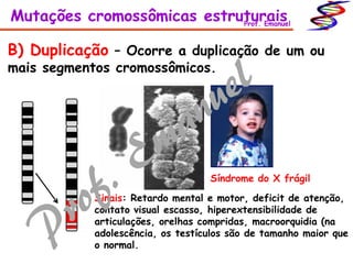 B) Duplicação – Ocorre a duplicação de um ou
mais segmentos cromossômicos.
Sinais: Retardo mental e motor, deficit de atenção,
contato visual escasso, hiperextensibilidade de
articulações, orelhas compridas, macroorquidia (na
adolescência, os testículos são de tamanho maior que
o normal.
Síndrome do X frágil
Mutações cromossômicas estruturaisProf. Emanuel
 