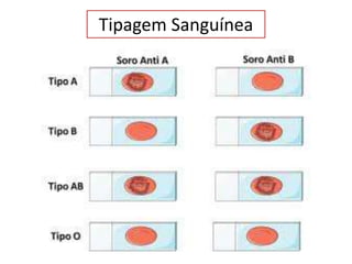 Tipagem Sanguínea
 