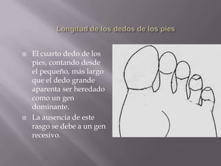 CalvicieLa condición es heredada como el resultado de un gen influenciado por el sexo que es dominante en varones y recesivo en hembras.