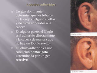 Lóbulos adheridosUn gen dominante determina que los lóbulos de la oreja cuelguen sueltos y no estén adheridos a la cabeza. En alguna gente, el lóbulo está adherido directamente a la cabeza de manera que no hay un lóbulo suelto. El lóbulo adherido es una condición homocigota determinada por un gen recesivo.