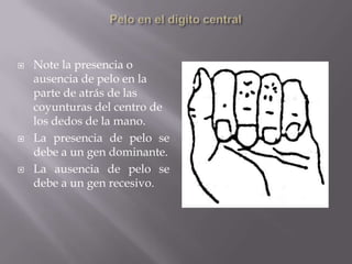Pelo en el dígito centralNote la presencia o ausencia de pelo en la parte de atrás de las coyunturas del centro de los dedos de la mano.La presencia de pelo se debe a un gen dominante. La ausencia de pelo se debe a un gen recesivo.