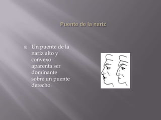 Puente de la narizUn puente de la nariz alto y convexo aparenta ser dominante sobre un puente derecho.  