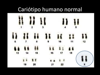 Cariótipo humano normal<br />