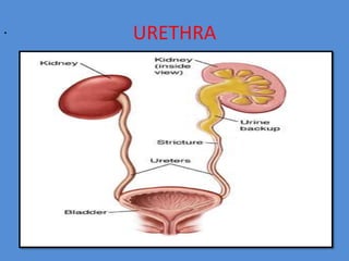 . URETHRA
 
