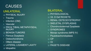 CAUSES
UNILATERAL
 PHYSEAL INJURY
 Trauma
 Infection (OM)
 Vascular
 PROX TIBIAL METAPHYSEAL
INJURY
 BENIGN TUMORS
 Fibrous Dysplasia
 Osteochondroma
 Olliers disease
 LATERAL LIGAMENT LAXITY
 Idiopathic
BILATERAL
 PHYSIOLOGICAL
 Vit. D Def RICKETS
 RENAL OSTEODYSTROPHY
 SKELETAL DYSPLASIAS
 Chondroctodermal Dysplasia
 SYNDROMES
 Morqio syndrome (MPS IV)
 Psuedoachondoplasia
 CP
 OI
 PAGETS DISEASE
 