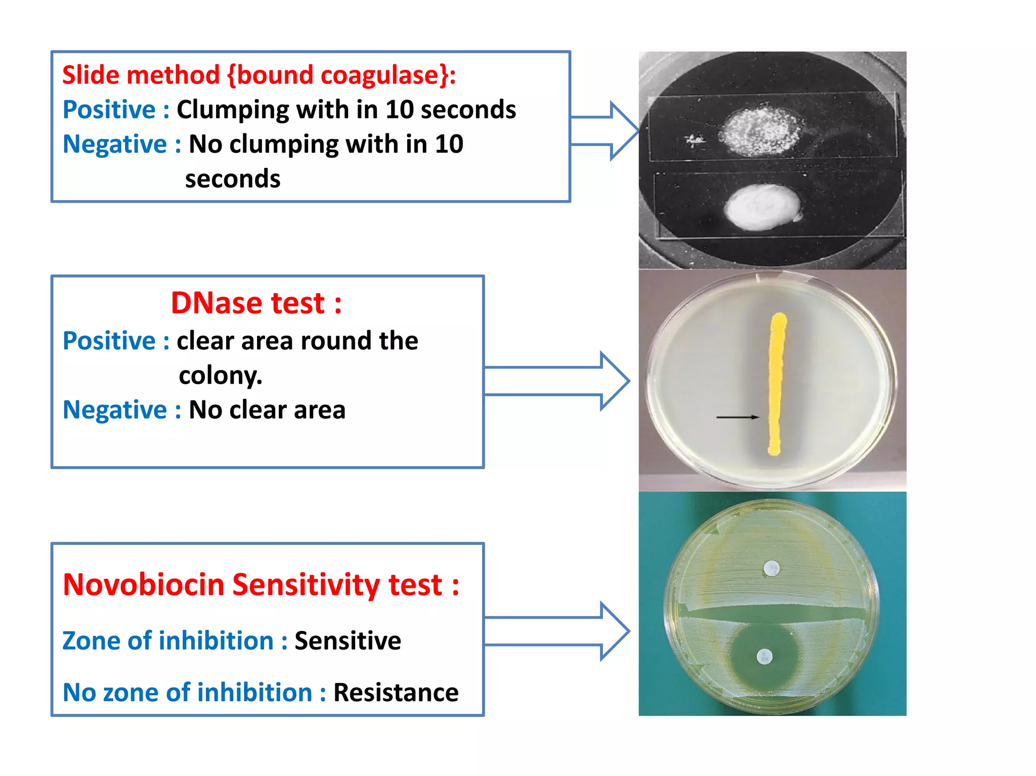 DNase test :
Positive : clear area round the
colony.
Slide method {bound coagulase}:
Positive : Clumping with in 10 seconds
Negative : No clumping with in 10
seconds
colony.
Negative : No clear area
Novobiocin Sensitivity test :
Zone of inhibition : Sensitive
No zone of inhibition : Resistance
 