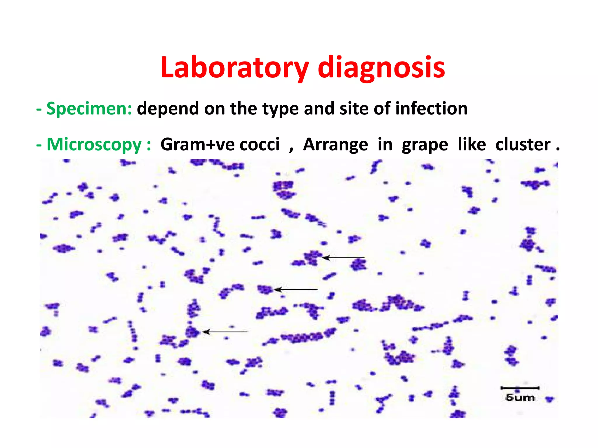 Laboratory diagnosis
- Specimen: depend on the type and site of infection
- Microscopy : Gram+ve cocci , Arrange in grape like cluster .
 