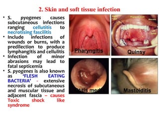 2. Skin and soft tissue infection
• S. pyogenes causes
subcutaneous infections
ranging cellutitis to
necrotising fascilitis
• Include infections of
wounds or burns, with a
predilection to produce
lymphangitis and cellulitis
• Infection of minor
abrasions may lead to
fatal septicemia
• S. pyogenes is also known
as ‘FLESH EATING
BACTERIA’ - extensive
necrosis of subcutaneous
and muscular tissue and
adjacent fascia – causes
Toxic shock like
syndrome
Quinsy
Mastoiditis
Pharyngitis
Otitis media
 