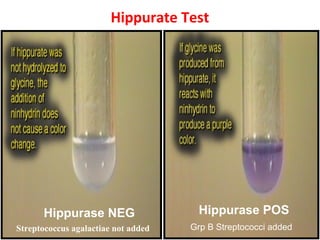 Hippurate Test
Hippurase NEG
Streptococcus agalactiae not added
Hippurase POS
Grp B Streptococci added
 