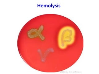 Hemolysis
 