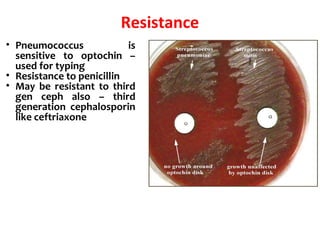 Resistance
• Pneumococcus is
sensitive to optochin –
used for typing
• Resistance to penicillin
• May be resistant to third
gen ceph also – third
generation cephalosporin
like ceftriaxone
 