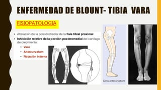 FISIOPATOLOGIA
ENFERMEDAD DE BLOUNT- TIBIA VARA
 