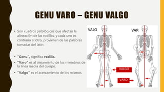GENU VARO – GENU VALGO
• Son cuadros patológicos que afectan la
alineación de las rodillas, y cada uno es
contrario al otro, provienen de las palabras
tomadas del latín:
• “Genu”, significa rodilla.
• “Varo” es al alejamiento de los miembros de
la línea media del cuerpo.
• “Valgo” es el acercamiento de los mismos.
VARO
VALGO
 