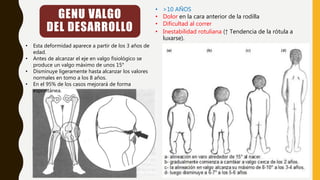 GENU VALGO
DEL DESARROLLO
• Esta deformidad aparece a partir de los 3 años de
edad.
• Antes de alcanzar el eje en valgo fisiológico se
produce un valgo máximo de unos 15°
• Disminuye ligeramente hasta alcanzar los valores
normales en tomo a los 8 años.
• En el 95% de los casos mejorará de forma
espontánea.
• >10 AÑOS
• Dolor en la cara anterior de la rodilla
• Dificultad al correr
• Inestabilidad rotuliana (↑ Tendencia de la rótula a
luxarse).
 