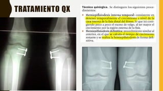 TRATAMIENTO QX
 