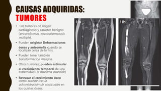 CAUSAS ADQUIRIDAS:
TUMORES
• Los tumores de origen
cartilaginoso y carácter benigno
(encondromas, encondromatosis
múltiple).
• Pueden originar Deformaciones
óseas y anisomelia cuando se
localizan cerca de la fisis.
• Pueden tener también
transformación maligna.
• Otros tumores; pueden estimular
el crecimiento temporal de una
extremidad (el osteoma osteoide)
• Retrasar el crecimiento óseo
como sucede tras la
administración de corticoides en
los quistes óseos.
 