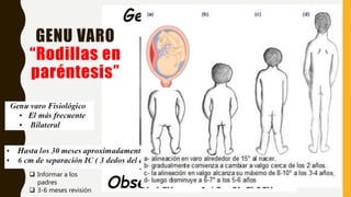 GENU VARO
“Rodillas en
paréntesis”
 Informar a los
padres
 3-6 meses revisión
 