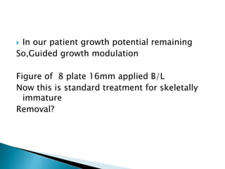  In our patient growth potential remaining
So,Guided growth modulation
Figure of 8 plate 16mm applied B/L
Now this is standard treatment for skeletally
immature
Removal?
 