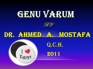 GENU VARUM BY DR.  AHMED   a.   Mostafa           Q.C.H.          2011 