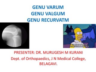 GENU VARUM
GENU VALGUM
GENU RECURVATM
PRESENTER: DR. MURUGESH M KURANI
Dept. of Orthopaedics, J N Medical College,
BELAGAVI.
 