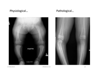 27/04/2015 13
Physiological… Pathological…
AYODELE A.E
 