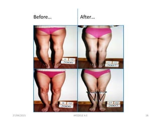 27/04/2015 18
Before… After…
AYODELE A.E
 
