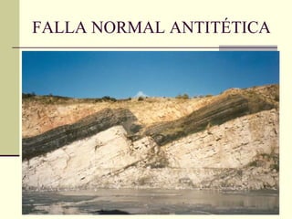 FALLA NORMAL ANTITÉTICA 