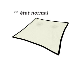 — état normal
p.26
 