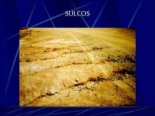 SULCOS 
 