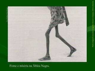 ParteintegrantedaobraGeografiaHomemeEspaço,EditoraSaraiva
Fome e miséria na África Negra.
TomStoddart/GettyImages
 