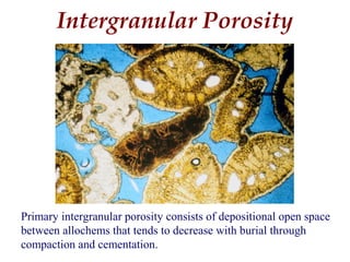 Primary intergranular porosity consists of depositional open space
between allochems that tends to decrease with burial through
compaction and cementation.
Intergranular Porosity
 