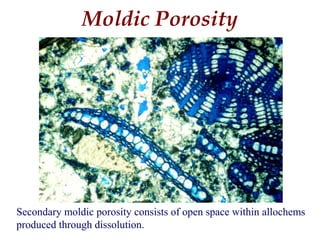 Secondary moldic porosity consists of open space within allochems
produced through dissolution.
Moldic Porosity
 