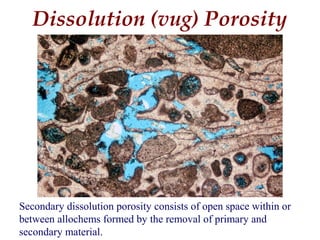 Secondary dissolution porosity consists of open space within or
between allochems formed by the removal of primary and
secondary material.
Dissolution (vug) Porosity
 