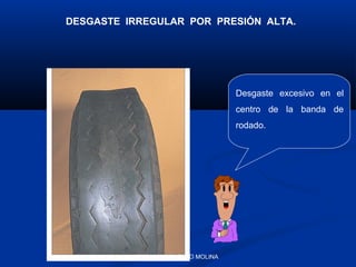 DESGASTE IRREGULAR POR PRESIÓN ALTA.

Desgaste excesivo en el
centro de la banda de
rodado.

TEC. JOEL SUELDO MOLINA

 