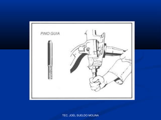 TEC. JOEL SUELDO MOLINA

 