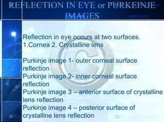 REFLECTION IN EYE or PURKEINJE
IMAGES
Reflection in eye occurs at two surfaces.
1.Cornea 2. Crystalline lens
Purkinje image 1- outer corneal surface
reflection
Purkinje image 2- inner corneal surface
reflection
Purkinje image 3 – anterior surface of crystalline
lens reflection
Purkinje image 4 – posterior surface of
crystalline lens reflection
 
