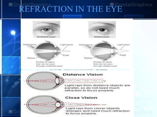 REFRACTION IN THE EYE
 